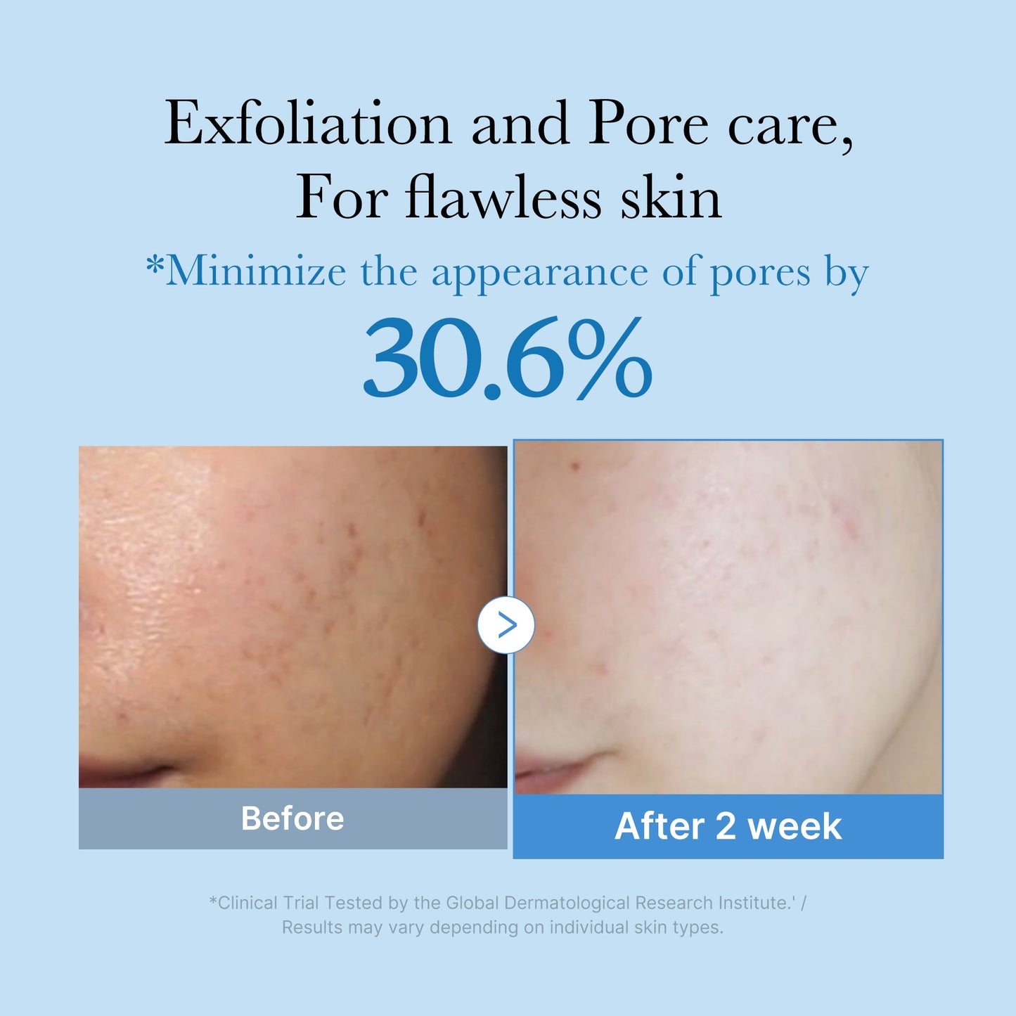 zero-pore-toner-h3 01_d6480b4e-3c08-4954-994a-ed5212c1839c.jpg
