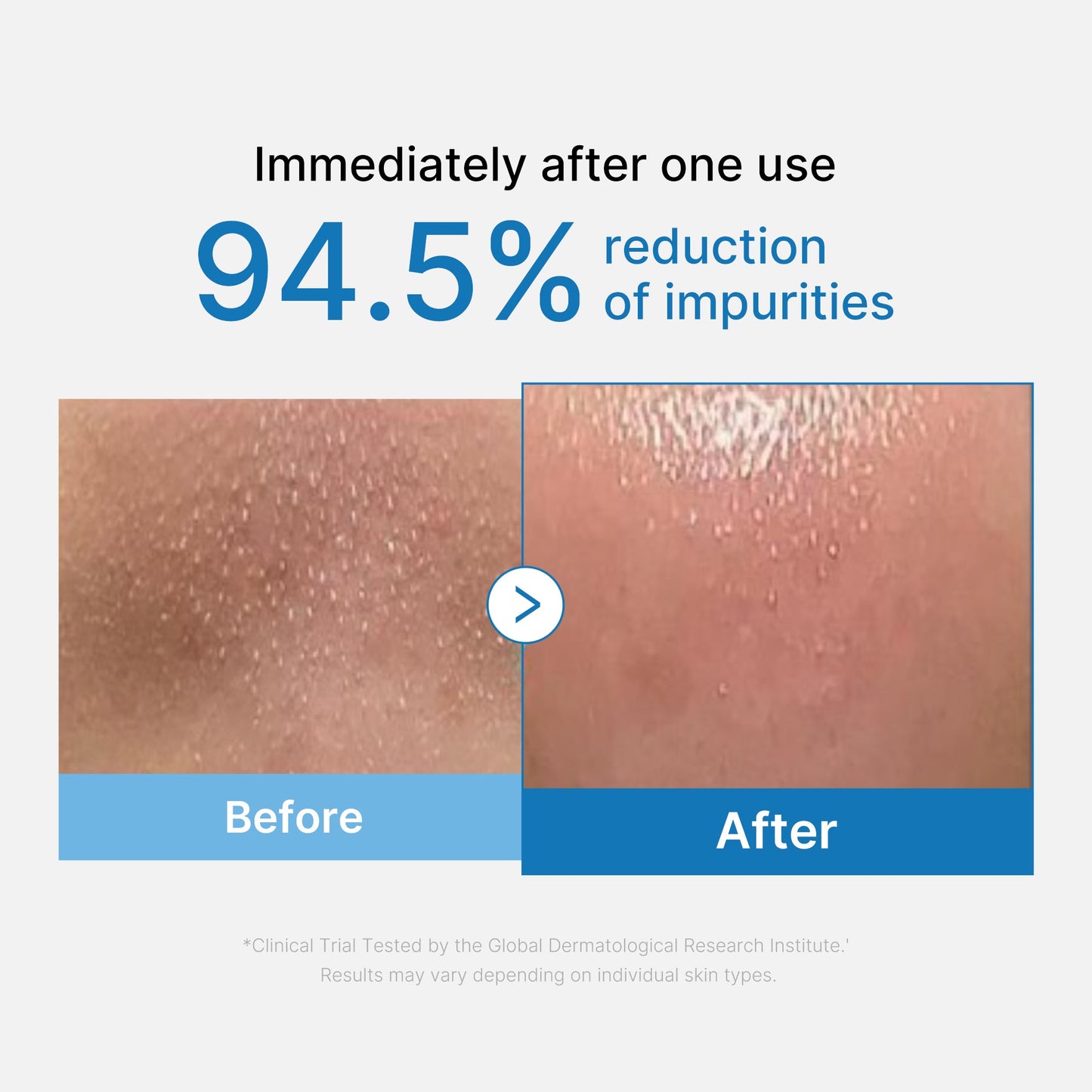 zero-pore-blackhead-deep-cleansing-oil-f1 01_eed557ec-5857-46a2-8b17-dbd67c692dcb.jpg
