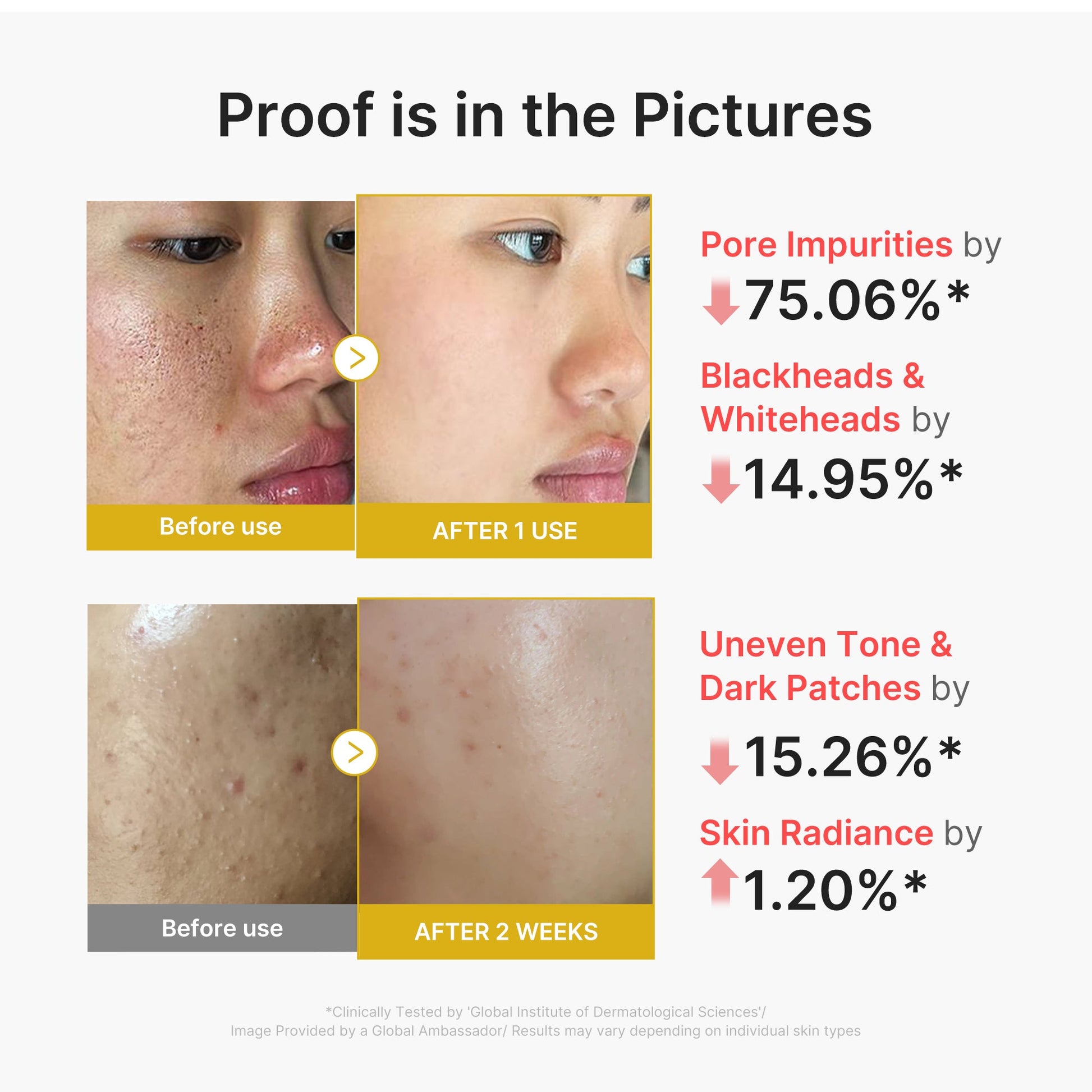 kojic-acid-turmeric-peel-shot-p4 02_45fe66d3-b3f6-4100-aa52-2afd7eded417.jpg