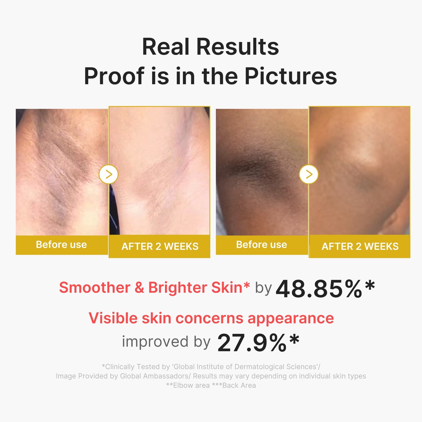 kojic-acid-turmeric-body-peel-shot-a0 02_72880cfc-382b-440b-8152-7e3dce87da2a.jpg