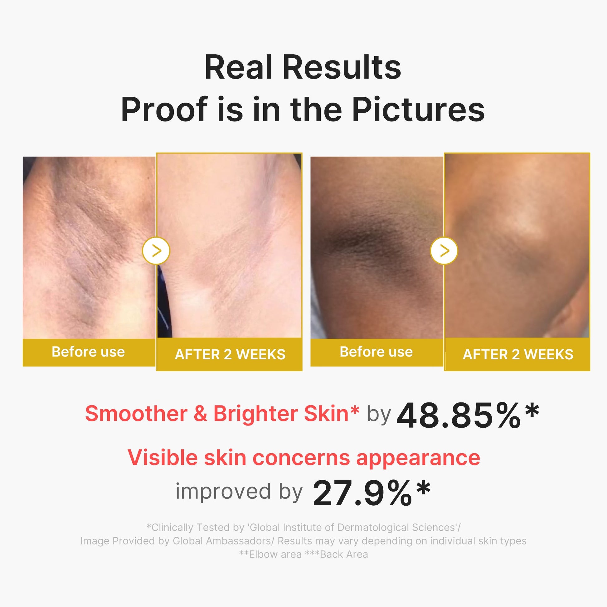kojic-acid-turmeric-body-peel-shot-a0 02_72880cfc-382b-440b-8152-7e3dce87da2a.jpg