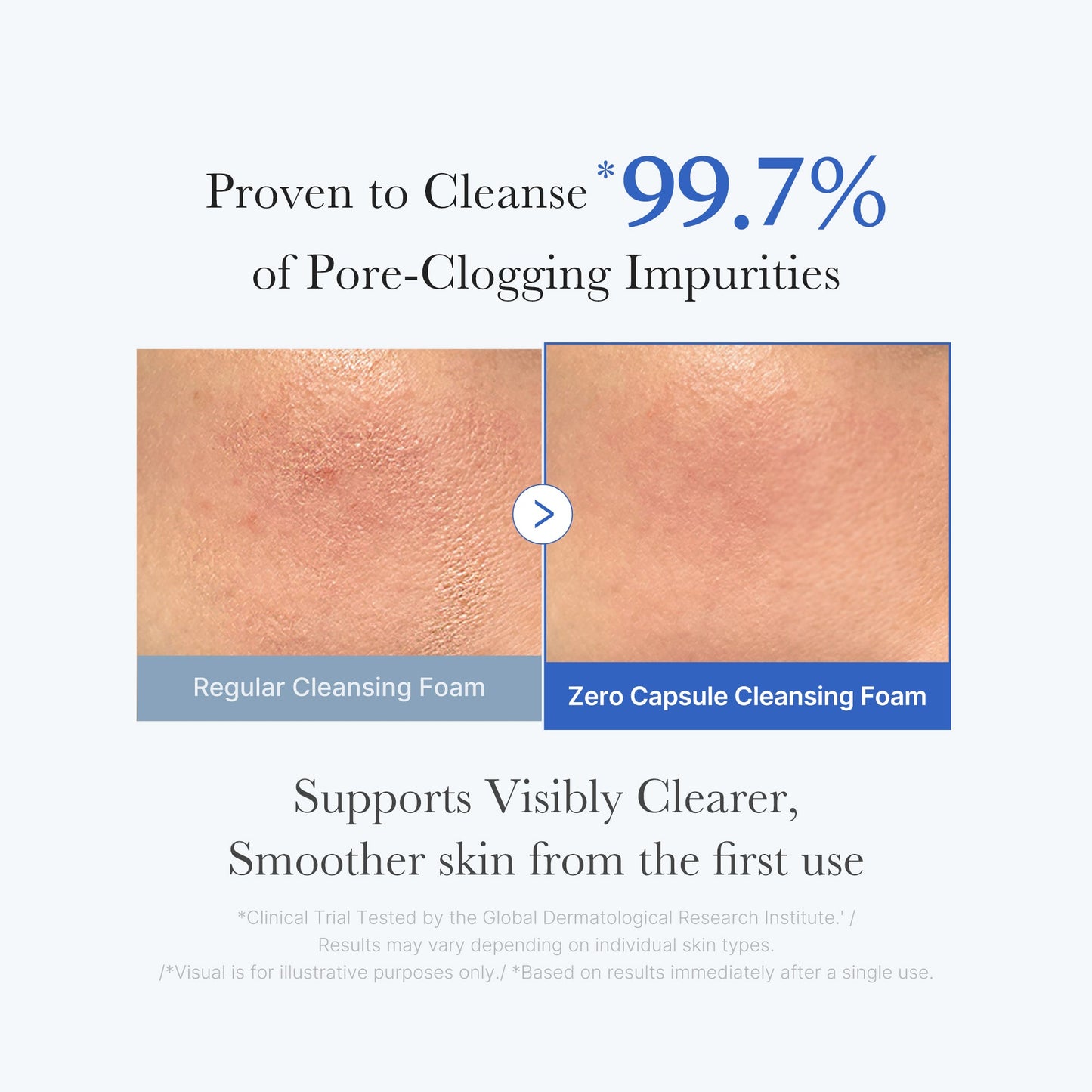 zero-pore-capsule-cleansing-foam-u7 02_c1fb9dfb-86c5-4038-8ff8-490d1006276c.jpg