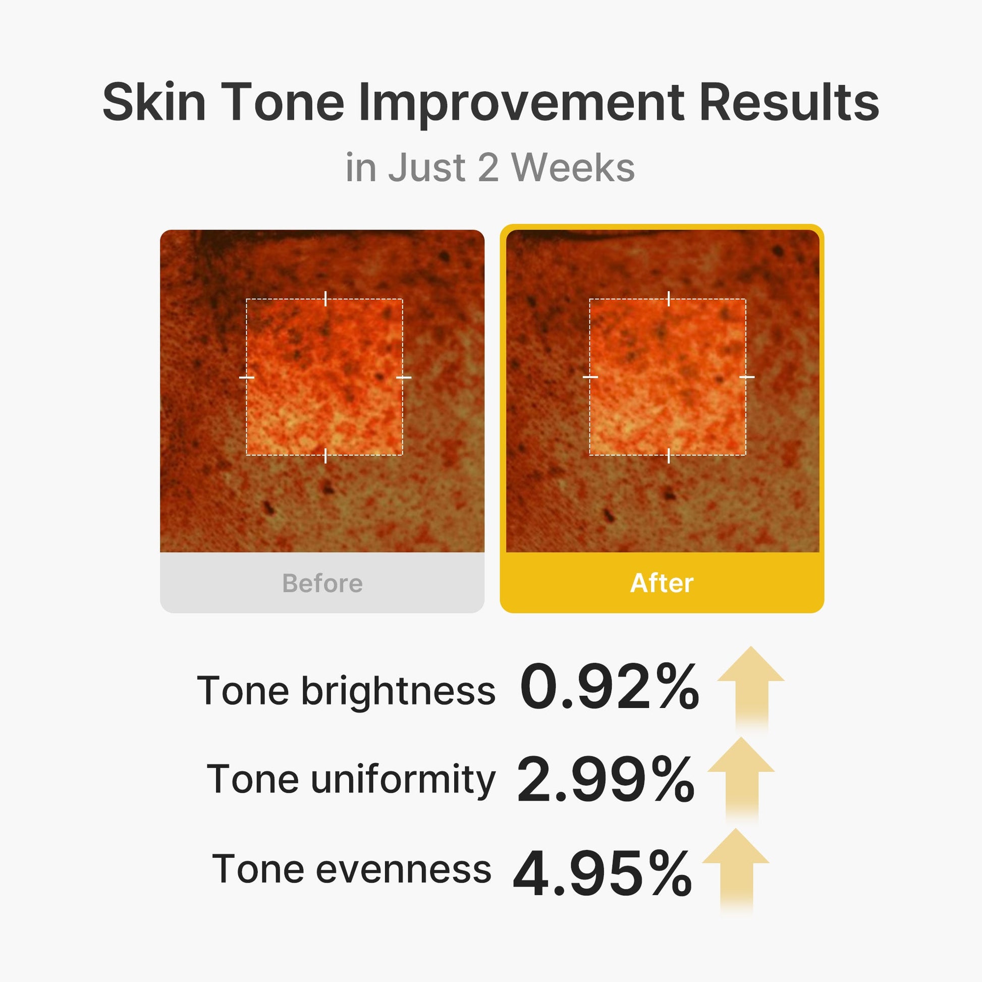 kojic-acid-turmeric-vita-capsule-cream-m1 03_2b626701-fc6c-4702-9e96-a2157a4f7f9d.jpg