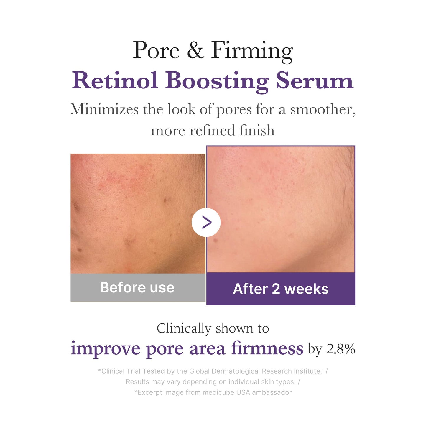 retinol-nmn-boosting-serum-k4 03_3510e7a5-5633-4a18-81ea-1389593bd517.jpg