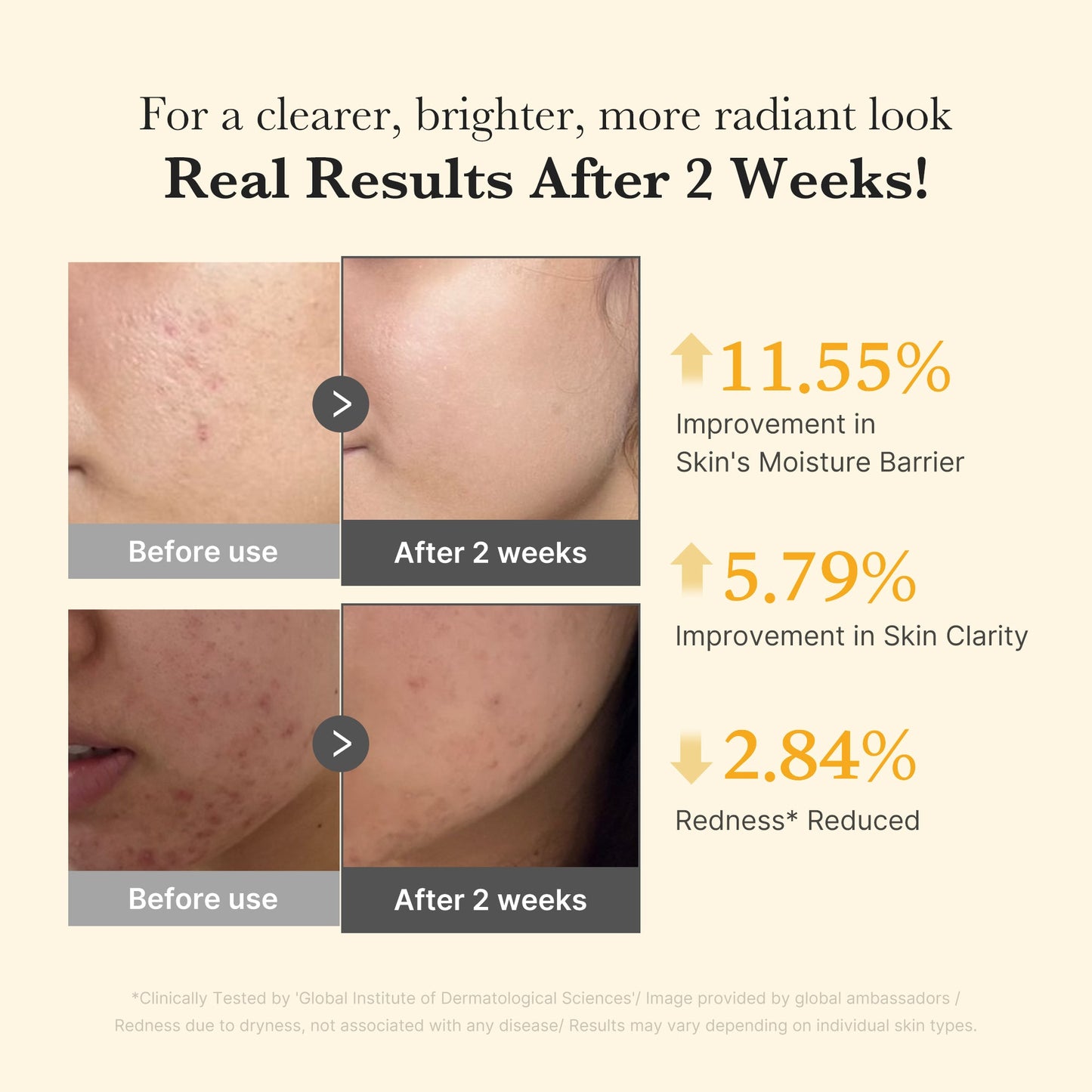 kojic-acid-turmeric-capsule-serum-r3 03_436487f5-76df-490e-8a61-01118373efbd.jpg