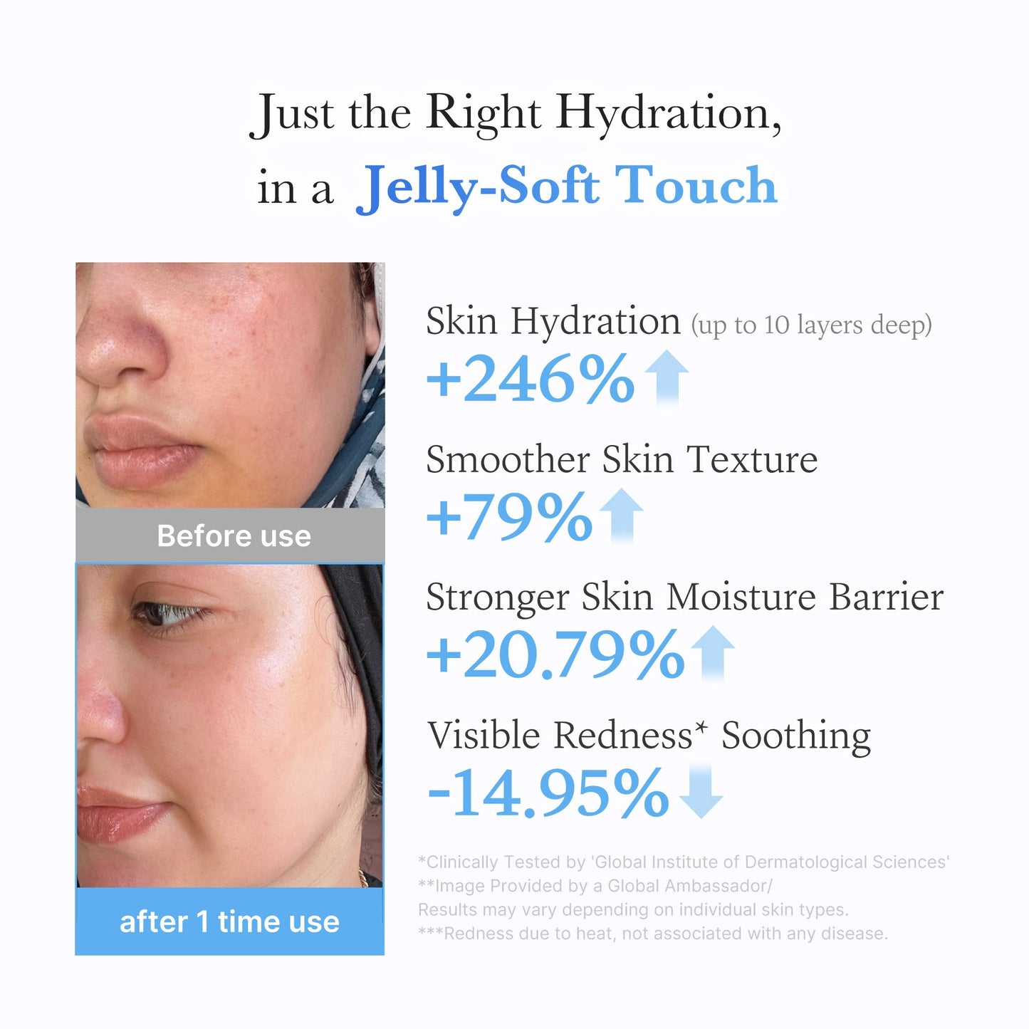 hyaluronic-ceramide-moisturizing-jelly-cream-d9 03_c39d66cc-0839-4e48-ab4a-d32143d06b1c.jpg