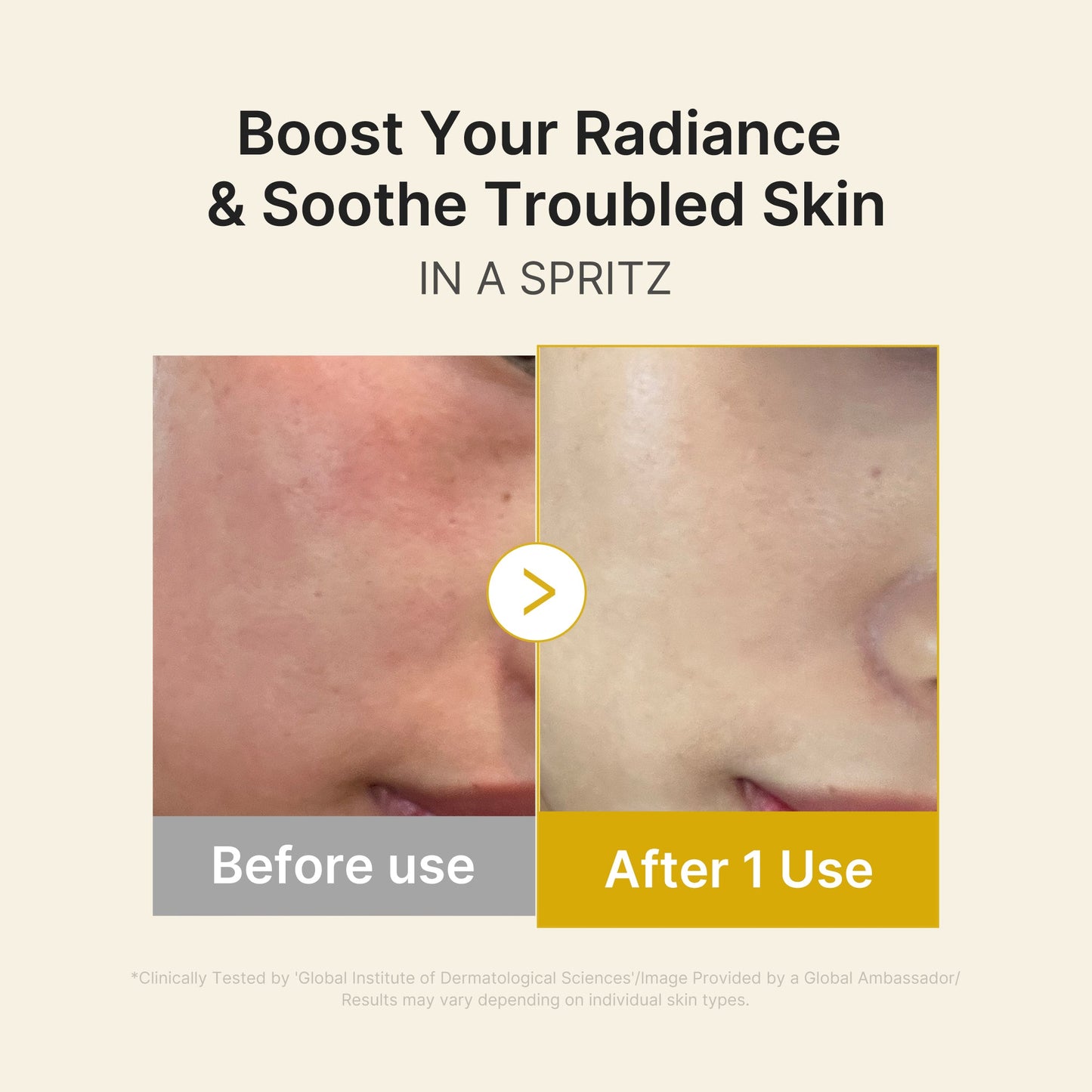 kojic-acid-turmeric-vitamin-gold-jelly-mist-serum-l4 03_dc9cd19e-4e57-49d3-9b66-c7762e8a63f1.jpg