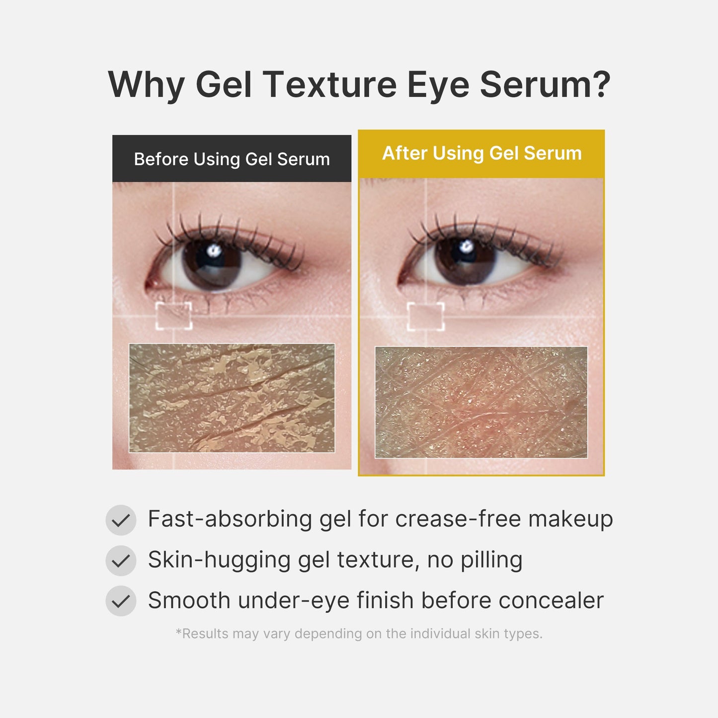kojic-acid-tumeric-eye-gel-serum-i8 04_0487ef36-49f4-4294-8049-bb55118b05fe.jpg