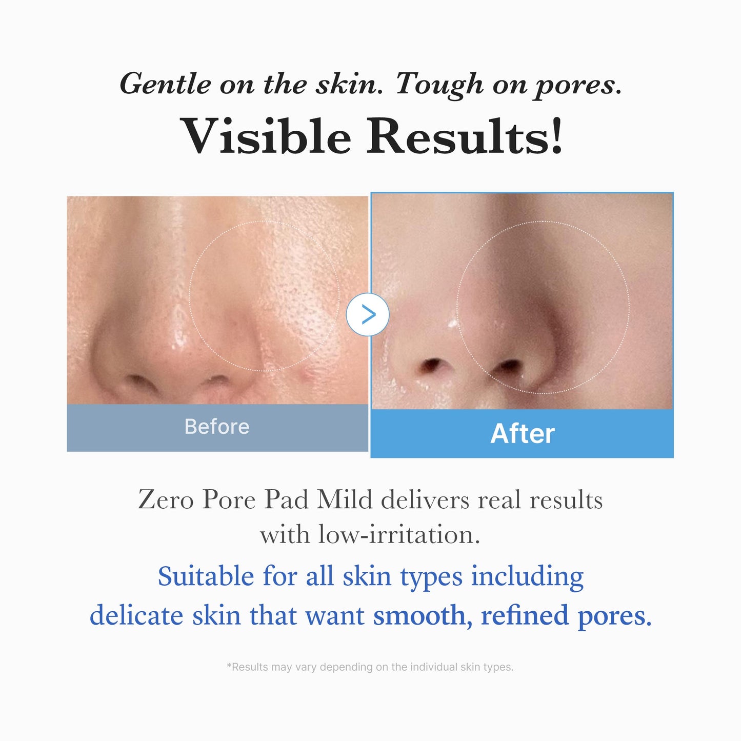 zero-pore-madecassoside-pads-mild-a6 04_6357f9f9-483b-4891-82c6-a58d336e62c8.jpg
