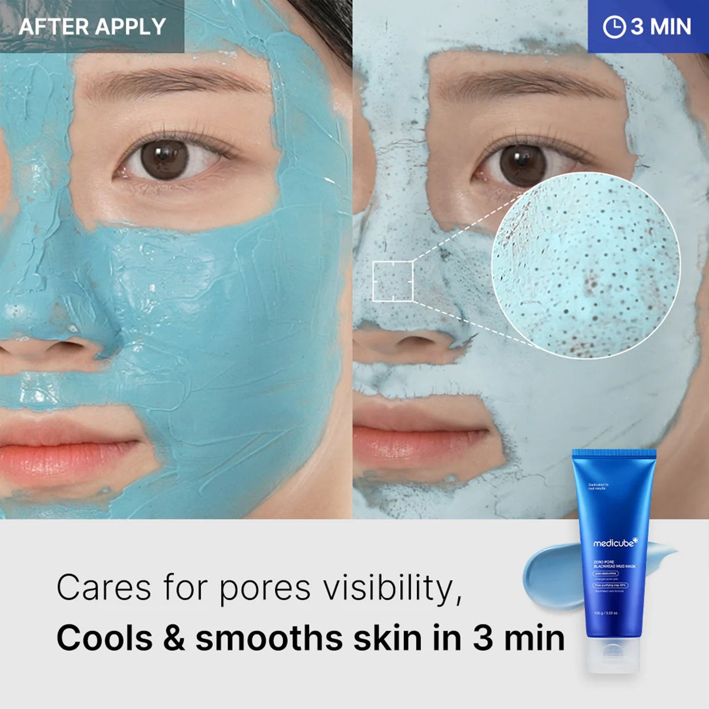 zero-pore-blackhead-mud-mask-r8 04_867c0459-a94e-40d3-bd9a-70400edabe8d.jpg