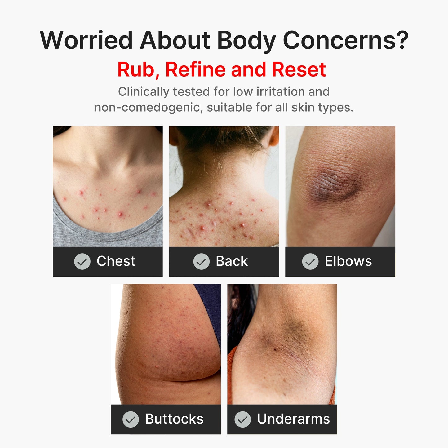 kojic-acid-turmeric-body-peel-shot-a0 04_8a7237f2-3ebf-401e-bd85-54841aeb3efc.jpg