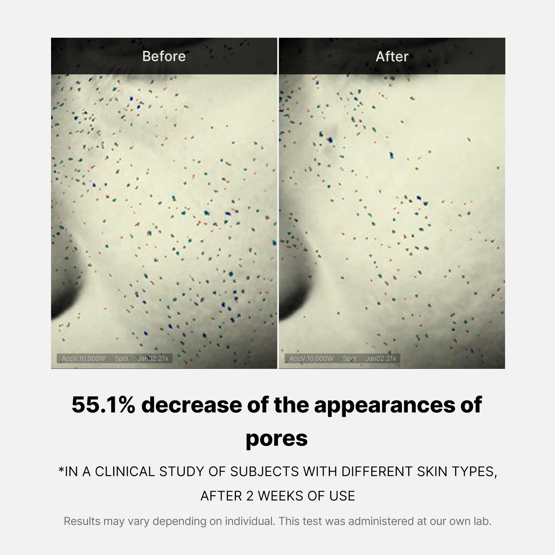 pore-care-duo-d1 05_12ddab8a-64be-4612-8ee1-27e5ec701921.jpg