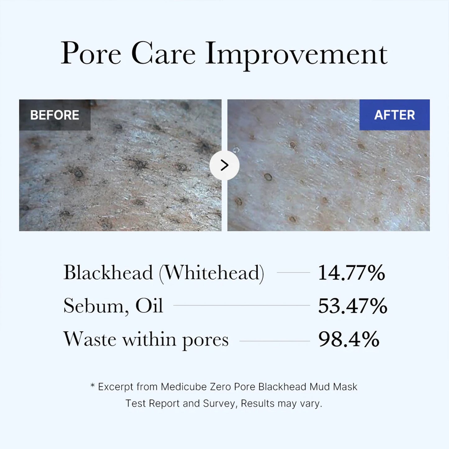 zero-pore-blackhead-mud-mask-r8 05_9362a158-c2b3-4525-acc0-631a2cfdea47.jpg