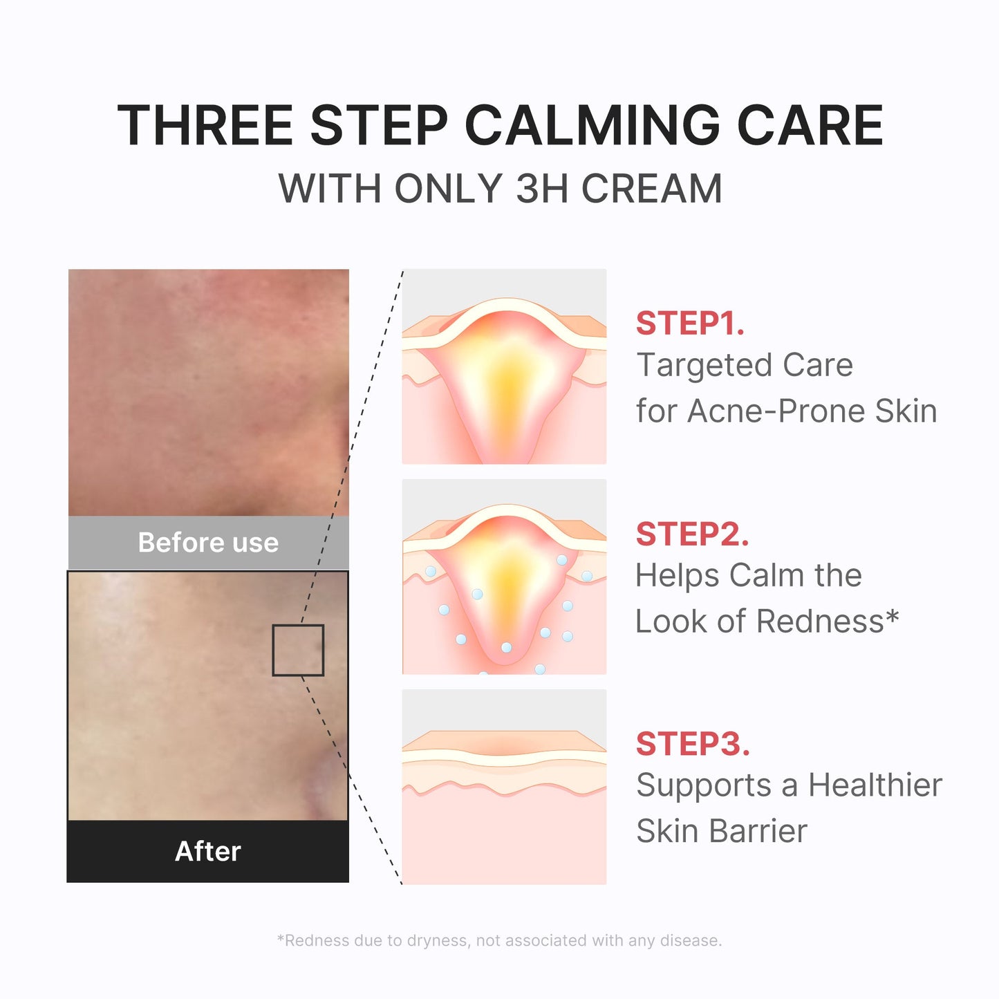 3h-daily-relief-cream-k6 3H_04.jpg