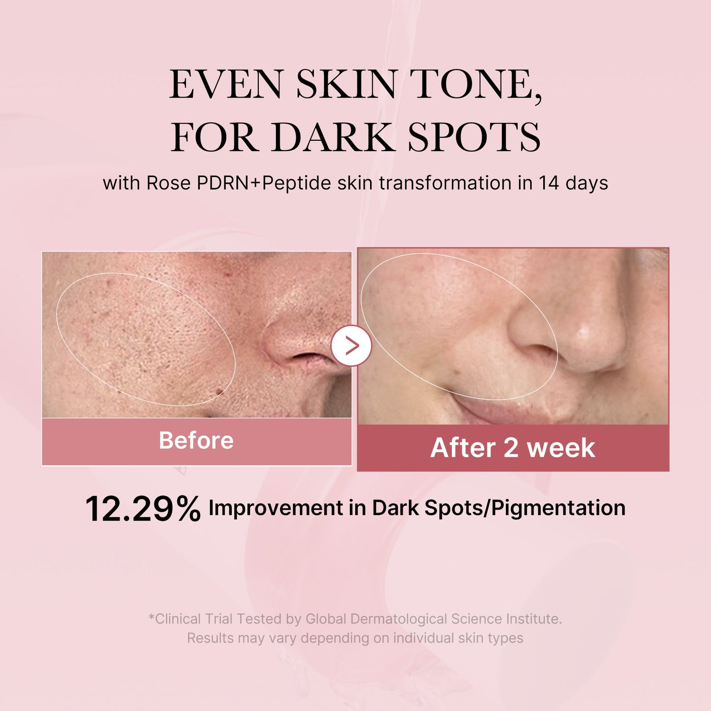 pdrn-pink-peptide-toner-p9 PDRN_01_308c518e-5ac6-4e54-99bd-eabc8796739b.jpg