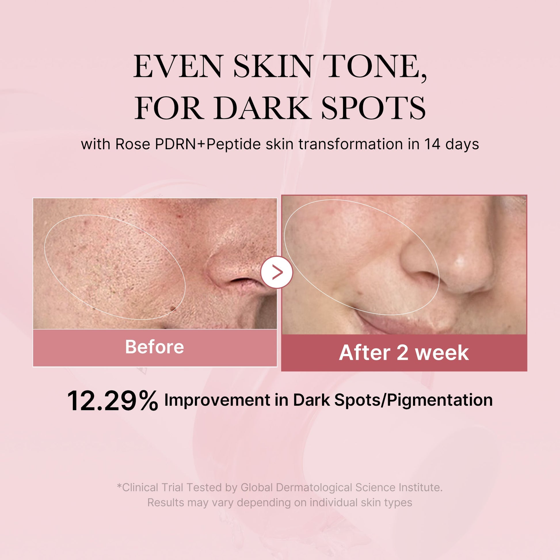 pdrn-pink-peptide-toner-p9 PDRN_01_308c518e-5ac6-4e54-99bd-eabc8796739b.jpg