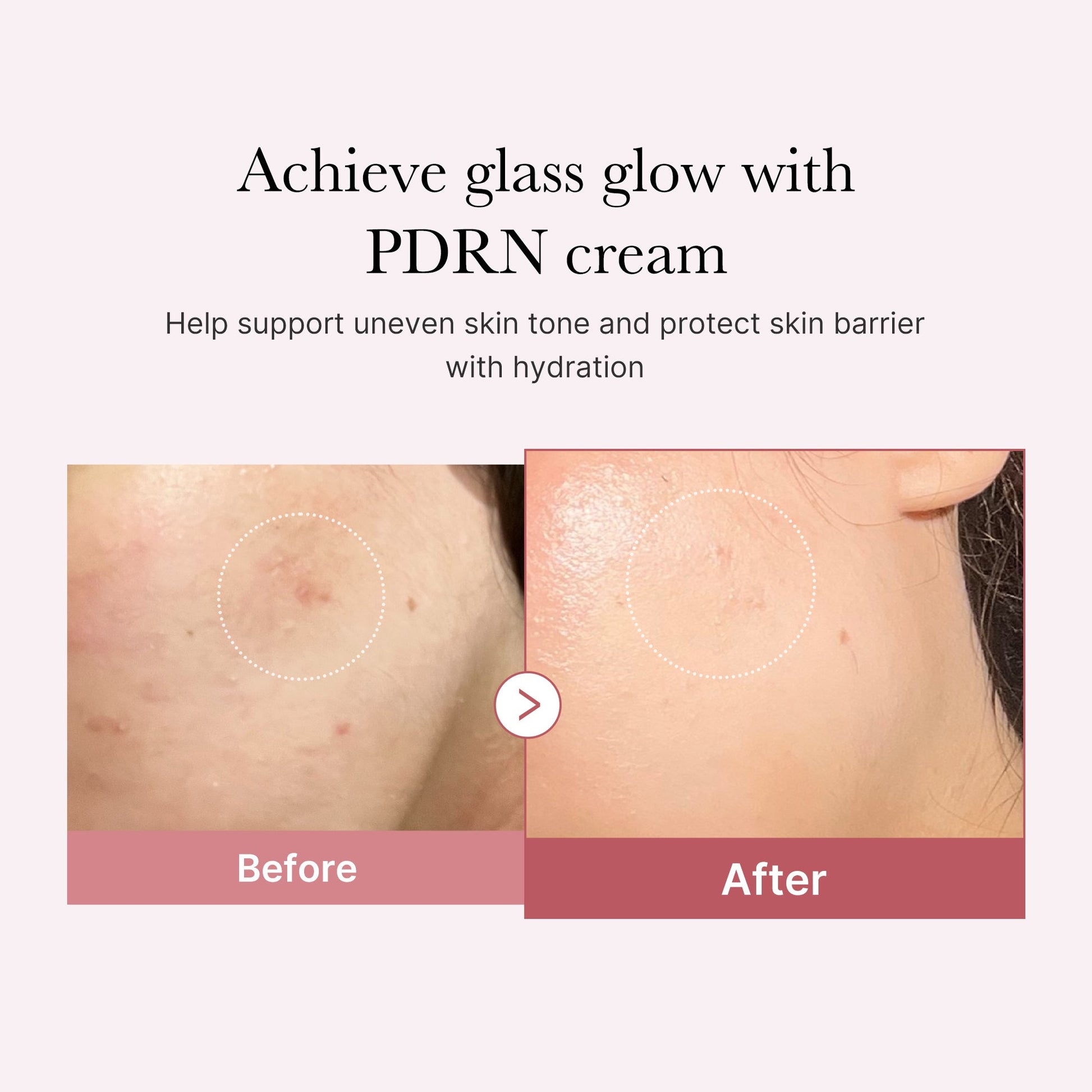 pdrn-pink-peptide-cream-x8 PDRN_02_d7805bfe-cf43-446a-b71b-a276683f136b.jpg