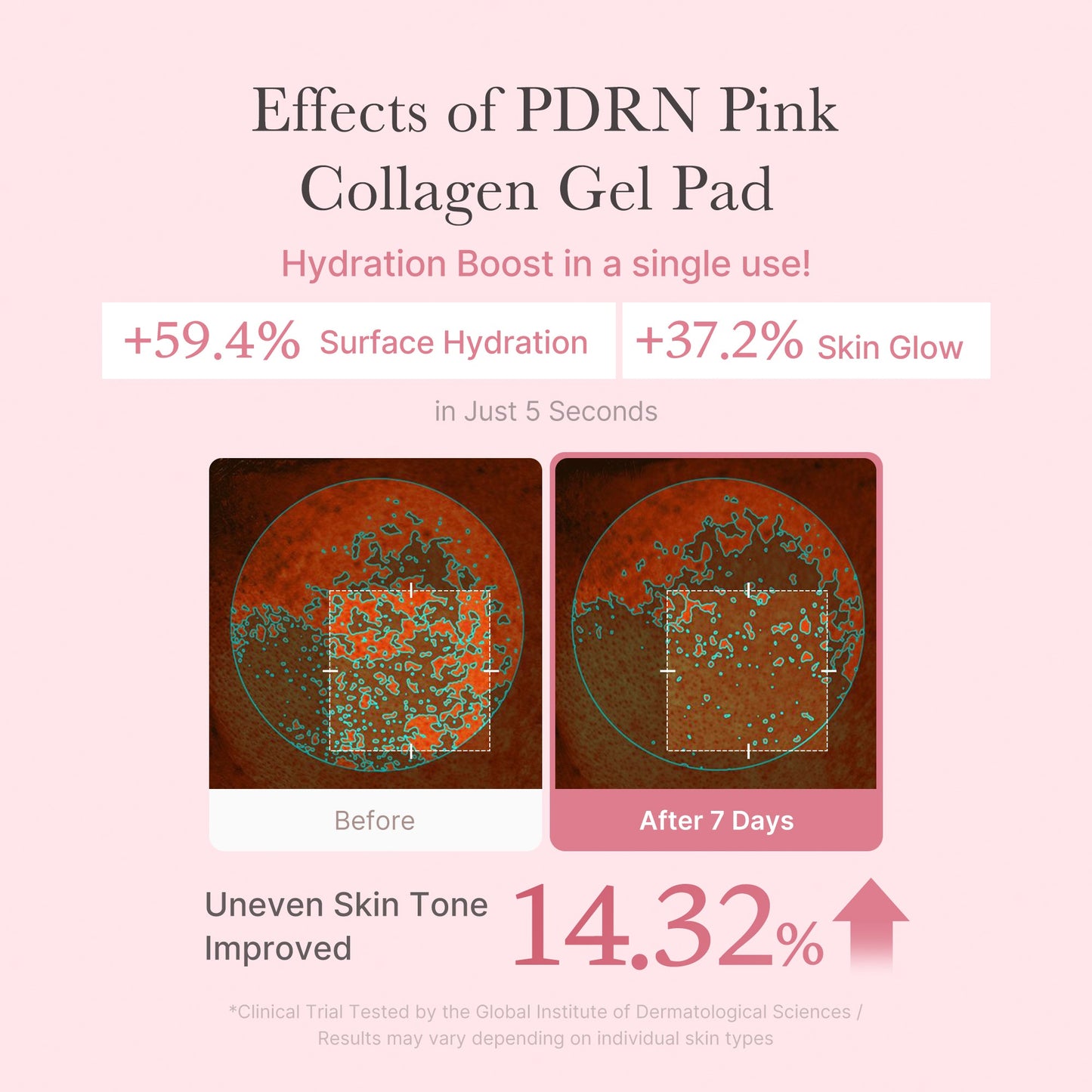 pdrn-pink-collagen-gel-toner-pad-p8 PDRN_04_f9a16a56-8d9e-4c47-a635-ed34ec3ed571.jpg