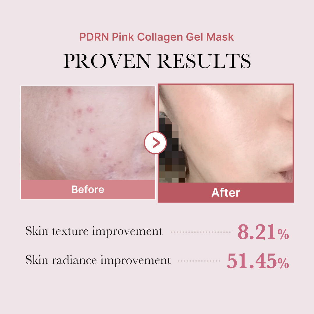 salmon-pdrn-pink-collagen-jelly-gel-mask-k9 PDRN_12.jpg